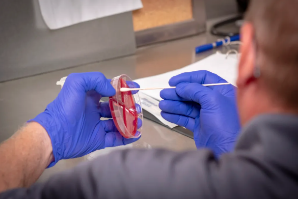 Lab culture sample